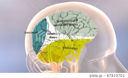 Amyloid Precursor Protein Processing and Alzheimer s Disease 87810701