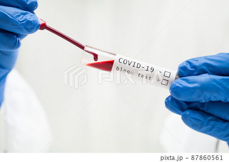 Lab technician dropping blood sample in test tube container using pipette 87860561