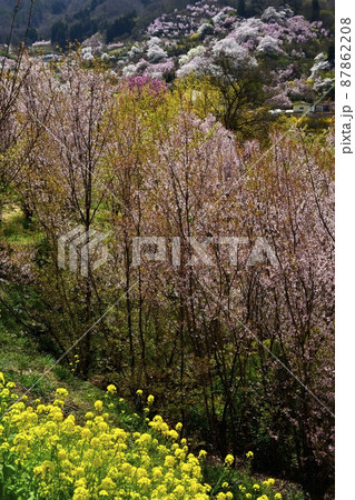 福島市の里山渡利地区の花咲く花見山公園 福島市の里山渡利地区の花咲く花見山公園 87862208