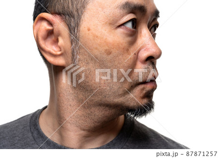 無精ひげのミドル男性　シミ　毛穴汚れ　スキンケア　マスクによる耳の擦れ 87871257