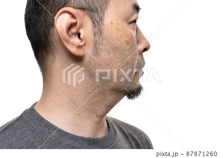 無精ひげのミドル男性 シミ 毛穴汚れ スキンケア マスクによる耳の擦れ 無精ひげのミドル男性 シミ 毛穴汚れ スキンケア マスクによる耳の擦れ 87871260