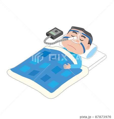 睡眠時無呼吸症候群を治療する男性 87873976