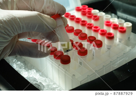 試験 実験する 実験 87887929