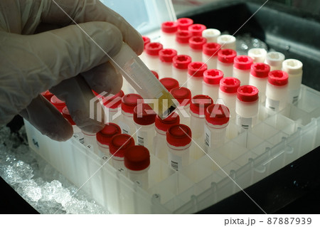 試験 実験する 実験 87887939