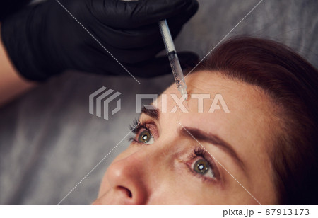 Close-up cosmetologist making injection in the forehead of a woman. Young woman gets beauty facial injections in salon. Face aging, rejuvenation and hydration procedures. Aesthetic cosmetology Close-up cosmetologist making injection in the forehead of a woman. Young woman gets beauty facial injections in salon. Face aging, rejuvenation and hydration procedures. Aesthetic cosmetology 87913173