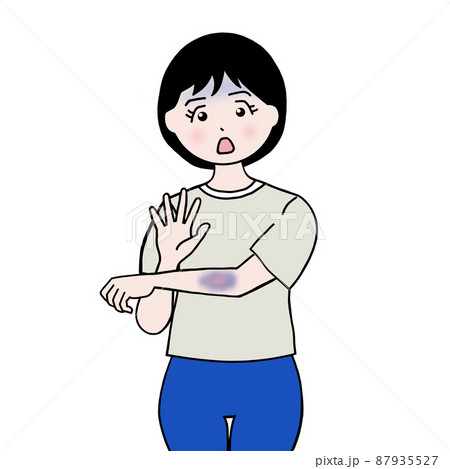 肌トラブルの女性 87935527