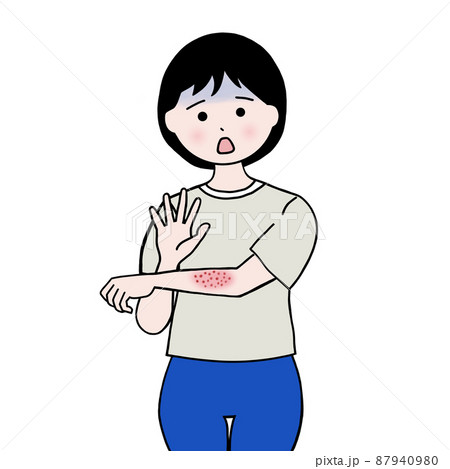 肌トラブルの女性 87940980