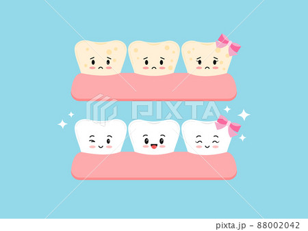 Cute tooth whitening and tooth with yellow plaque before, after icon set. 88002042