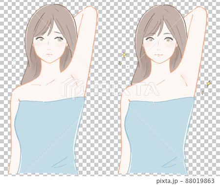 Before and after of a woman concerned about her armpits 88019863
