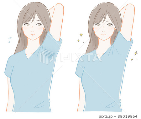 脇汗を気にする女性　ビフォーアフター 88019864