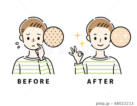 毛穴 鼻 ビフォーアフター 毛穴 鼻 ビフォーアフター 88022213