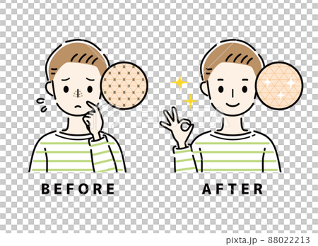 毛穴 鼻 ビフォーアフター 毛穴 鼻 ビフォーアフター 88022213