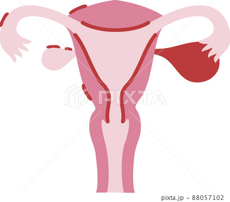 子宮のイラスト 子宮のイラスト 88057102