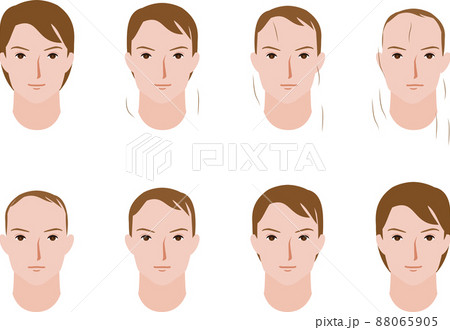 男性の毛量の増減するイラスト 男性の毛量の増減するイラスト 88065905