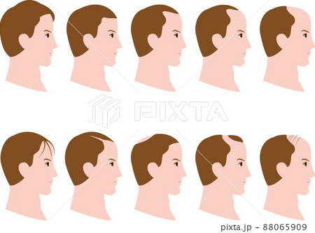 横顔の男性の毛量の増減するイラスト 横顔の男性の毛量の増減するイラスト 88065909