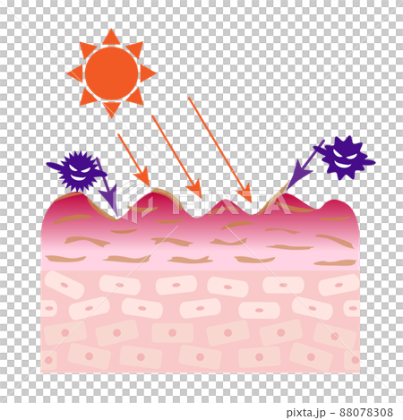 粗糙皮膚的橫截面。由紫外線引起的污漬的圖像。 88078308