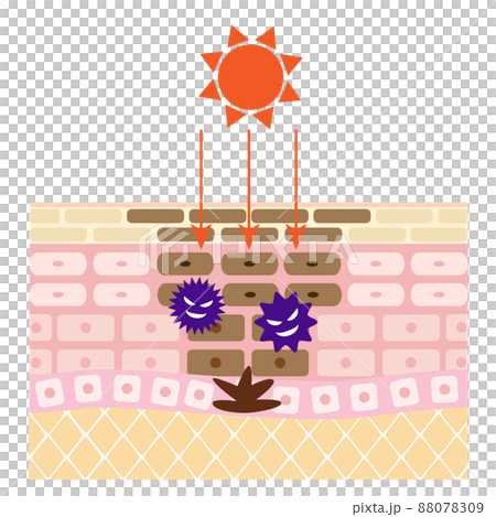 粗糙皮膚的橫截面。由紫外線引起的污漬的圖像。 88078309