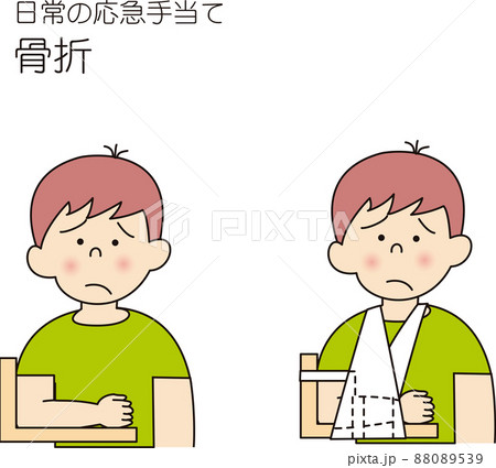 腕を骨折した場合の応急手当て 88089539