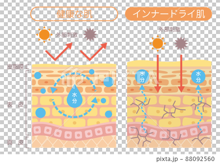 肌の構造_インナードライ肌 肌の構造_インナードライ肌 88092560