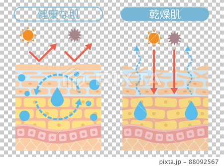皮膚結構_乾性皮膚 88092567