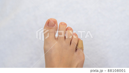 Medical plaster on the female little toe. Wound at toe healed with a band aid for medical care Medical plaster on the female little toe. Wound at toe healed with a band aid for medical care 88108001