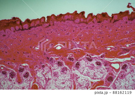 ヒトの表皮汗腺　顕微鏡画像 88162119