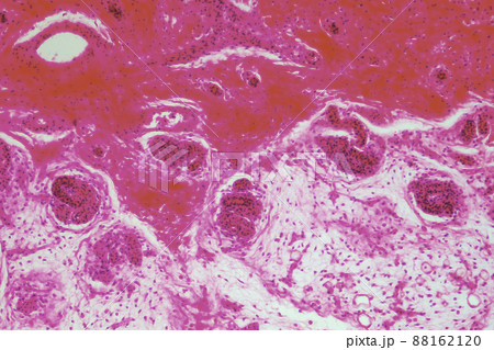 ヒトの表皮汗腺　顕微鏡画像 88162120
