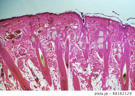 ヒトの表皮根毛　顕微鏡画像 88162129