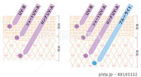 光による肌ダメージの肌図 88193332