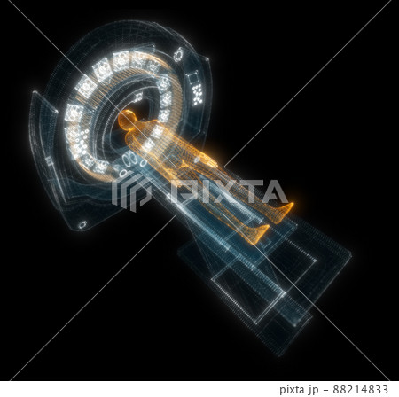 Digital MRI scan with patient Hologram. Medicine and Technology Concept 88214833