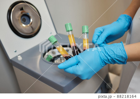 Beautician doctor's hands put test tube with blood in centrifuge container. Rejuvenation plasmolifting procedure. 88218164