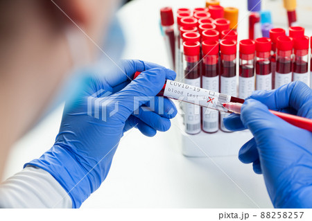 Doctor or lab scientist labelling test tube with Coronavirus patient blood sample Doctor or lab scientist labelling test tube with Coronavirus patient blood sample 88258257