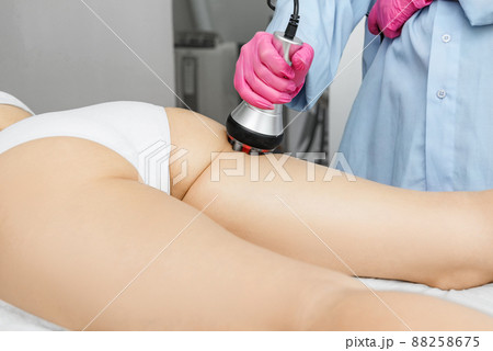 The doctor does the Rf lifting procedure on the legs, buttocks and hips of a woman in a beauty parlor. The doctor does the Rf lifting procedure on the legs, buttocks and hips of a woman in a beauty parlor. 88258675