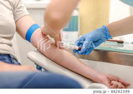 Close-up Of Doctor Taking Blood Sample From Patient's Arm in Hospital for Medical Testing. 88262399