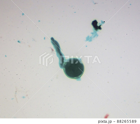 花粉の発芽 顕微鏡画像 花粉の発芽 顕微鏡画像 88265589