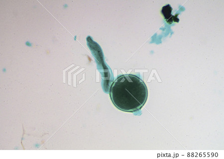 花粉の発芽 顕微鏡画像 花粉の発芽 顕微鏡画像 88265590