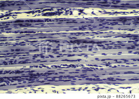 骨格筋（横紋筋）　顕微鏡画像 88265673