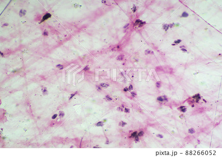 疎性結合組織 顕微鏡画像 疎性結合組織 顕微鏡画像 88266052