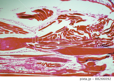 密性結合組織 顕微鏡画像 密性結合組織 顕微鏡画像 88266092