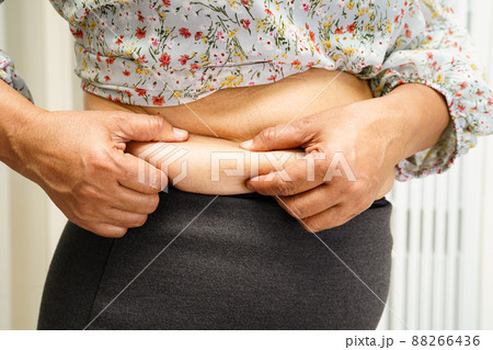 Overweight asian woman use hand to squeeze fat belly big size overweight and obesity. Overweight asian woman use hand to squeeze fat belly big size overweight and obesity. 88266436