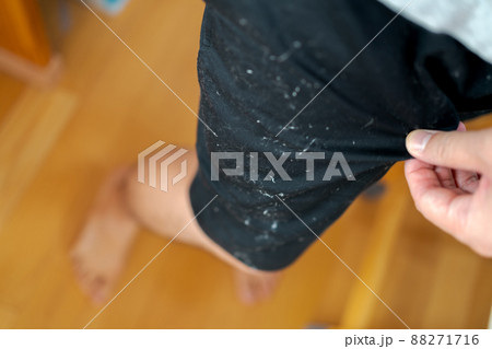 黒い服についたほこりが目立つ 88271716