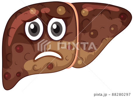 Fibrosis liver with face expression on white background Fibrosis liver with face expression on white background 88280297
