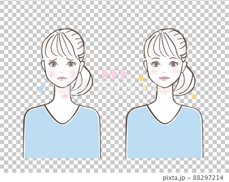 若い女性　スキンケア　シミ　肌荒れ 88297214