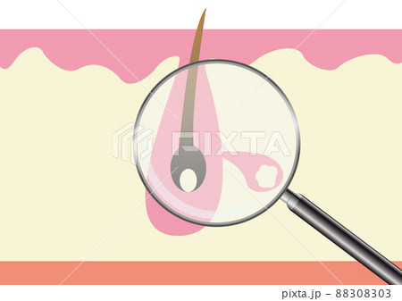 毛穴ズーム 毛穴ズーム 88308303