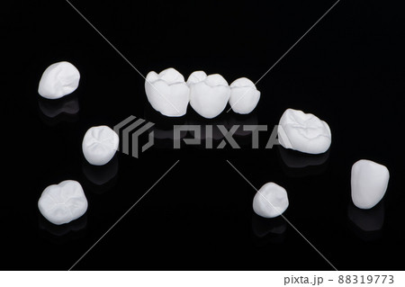 High aesthetic zirconia dentures and crowns on colorful background. Set of single dentures and dental crowns. High aesthetic zirconia dentures and crowns on colorful background. Set of single dentures and dental crowns. 88319773