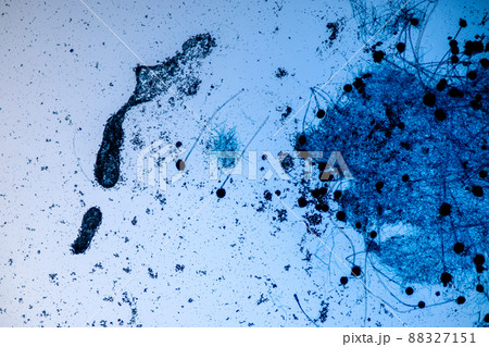 Aspergillus niger and Aspergillus oryzae  (mold) under microscope for Microbiology in Lab. 88327151
