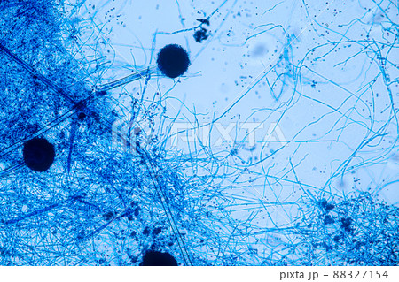 Aspergillus niger and Aspergillus oryzae  (mold) under microscope for Microbiology in Lab. 88327154