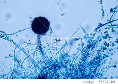 Aspergillus niger and Aspergillus oryzae  (mold) under microscope for Microbiology in Lab. 88327164