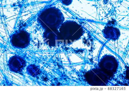 Aspergillus niger and Aspergillus oryzae  (mold) under microscope for Microbiology in Lab. 88327165