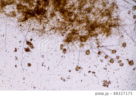 Aspergillus niger and Aspergillus oryzae  (mold) under microscope for Microbiology in Lab. 88327175
